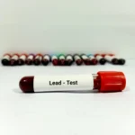 A_Test_Tube_of_Blood_with_a_Lead_Test_Label_Representing_Magellan_Diagnostics_Which_Pled_Guilty_to_Failing_to_Disclose_Problems_with_Its_Tests