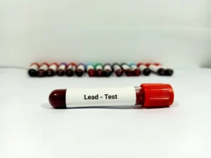 A_Test_Tube_of_Blood_with_a_Lead_Test_Label_Representing_Magellan_Diagnostics_Which_Pled_Guilty_to_Failing_to_Disclose_Problems_with_Its_Tests